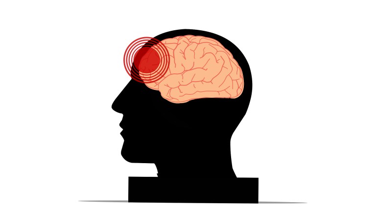 Illustration of a head silhouette and a brain with a red area