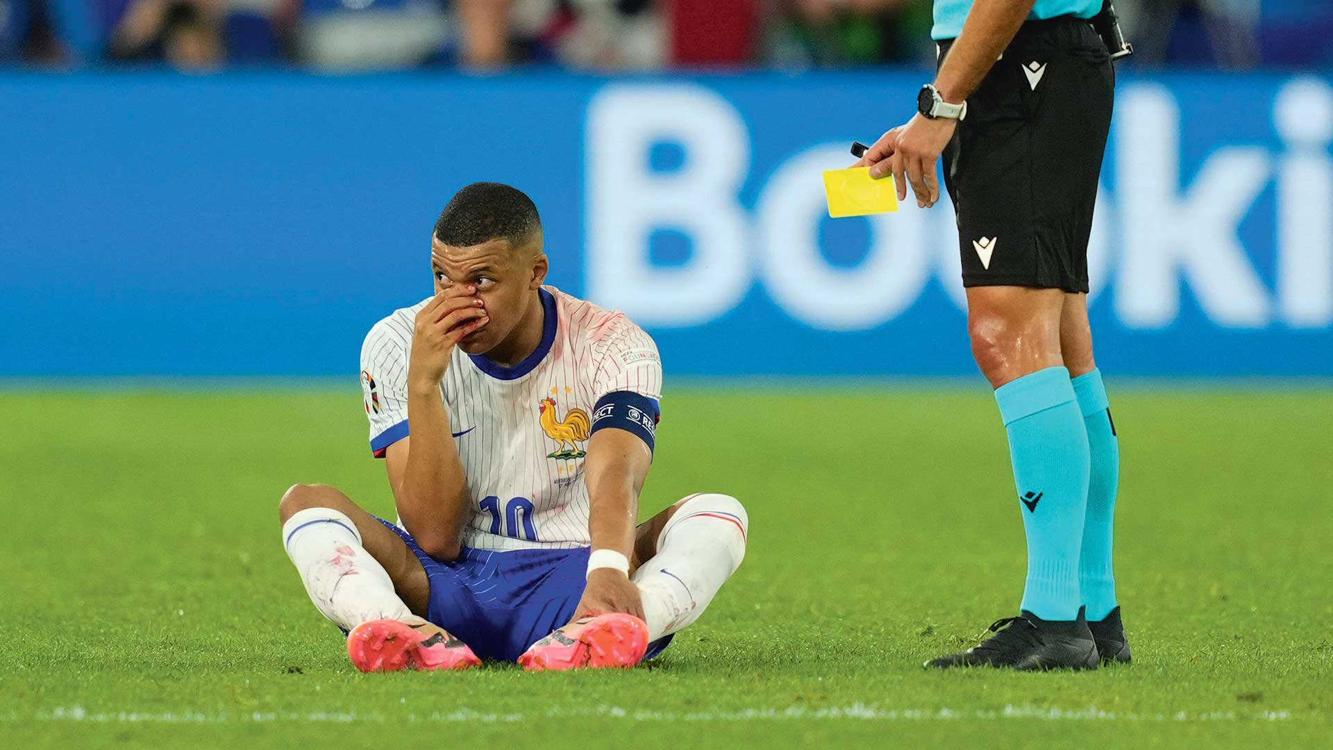 Kylian Mbappé after breaking his nose against Austria