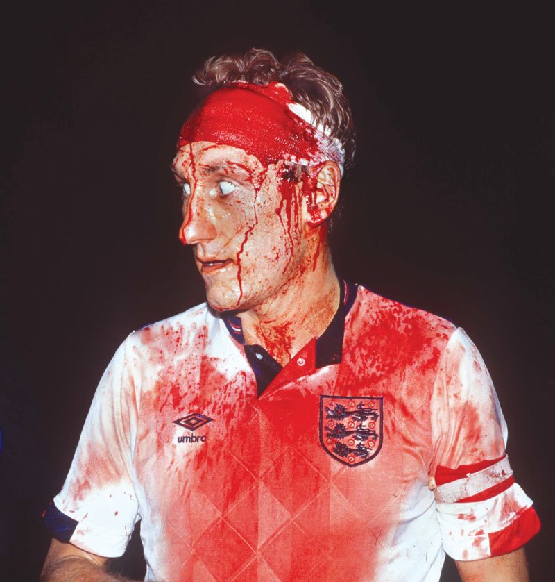 A bloodied Terry Butcher against Sweden in 1989